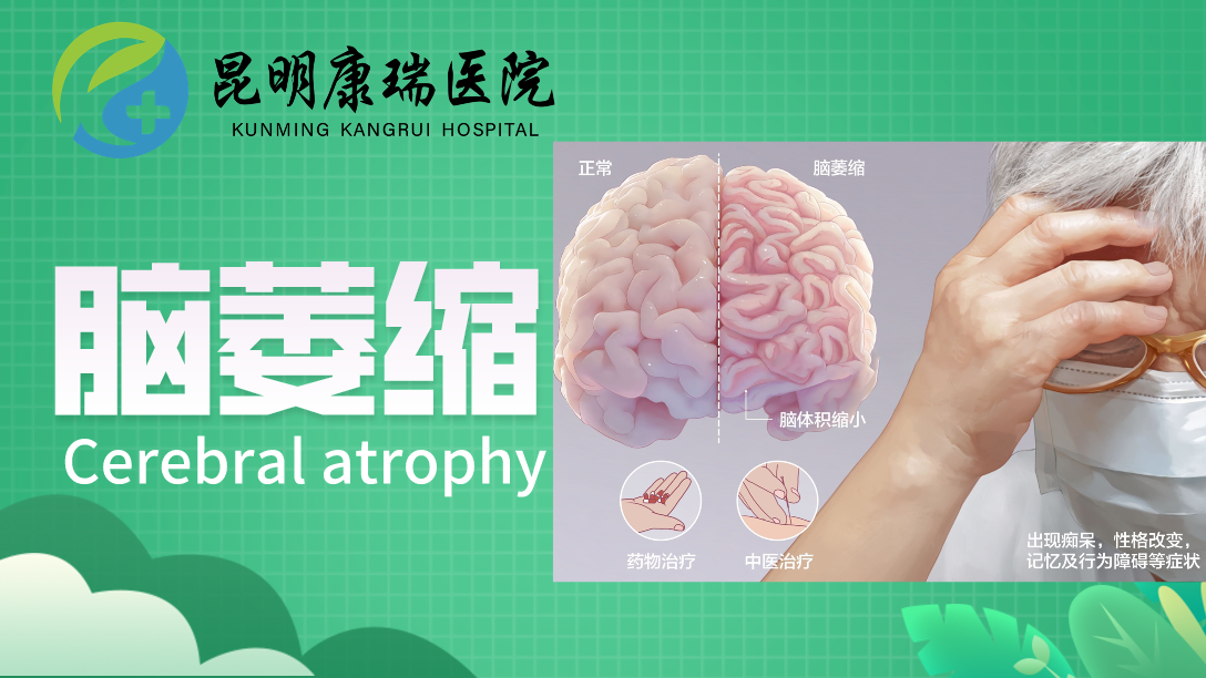 脑萎缩  (21)
